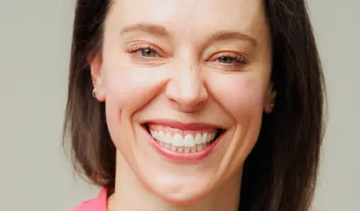 bonding after - smile - Laura - The Modern Dentist