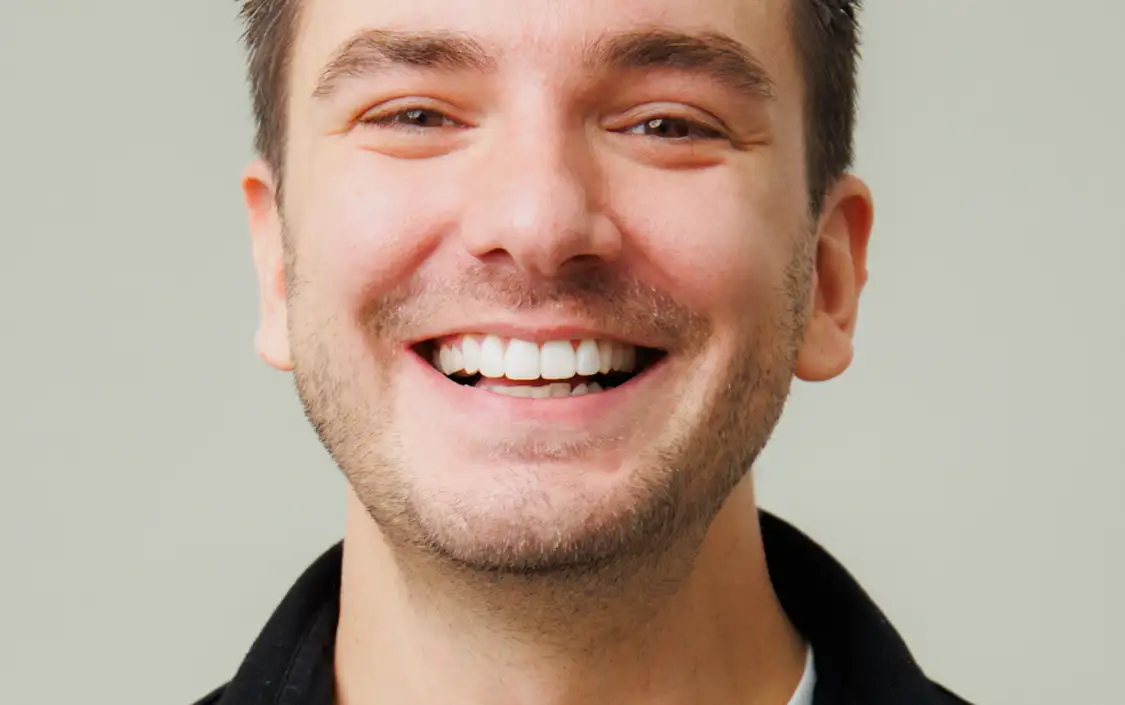 Composite bonding testimonial - The Modern Dentist - Mark Farrant